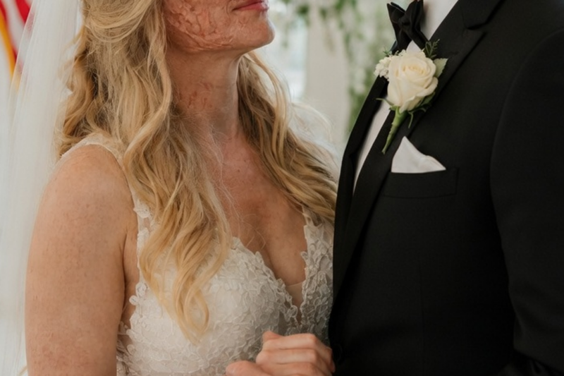 The Scars We Choose to Love: A Wedding Night Confession That Healed Two Broken Souls