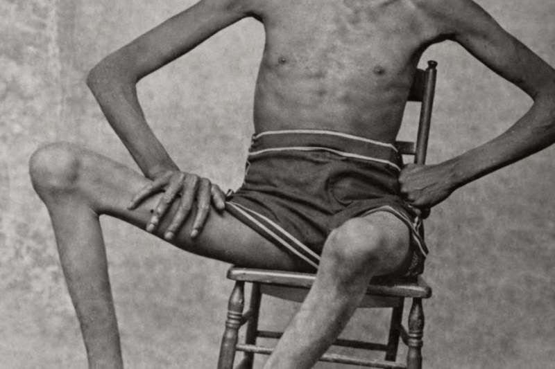 THEY BURIED HIM UNDER CONCRETE — THE TALLEST BLACK MAN IN HISTORY REFUSED TO BE A SPECTACLE